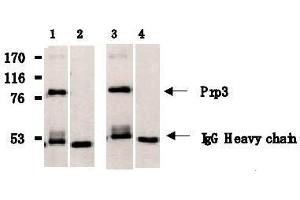 Western Blotting (WB) image for anti-PRP3 Pre-mRNA Processing Factor 3 Homolog (PRPF3) antibody (ABIN1449201) (PRPF3 anticorps)