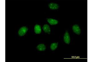 Immunofluorescence of purified MaxPab antibody to PLK1 on HeLa cell.