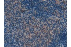 IHC-P analysis of Mouse Spleen Tissue, with DAB staining.