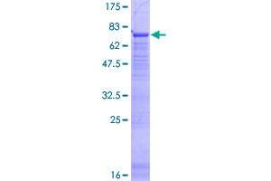 Image no. 1 for Protein Tyrosine Phosphatase-Like (Proline Instead of Catalytic Arginine), Member B (PTPLB) (AA 1-254) protein (GST tag) (ABIN1316812)
