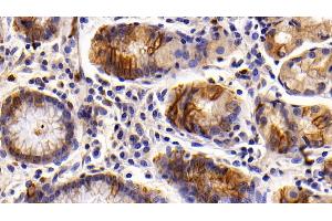 Detection of KRT6A in Human Stomach Tissue using Polyclonal Antibody to Keratin 6A (KRT6A)