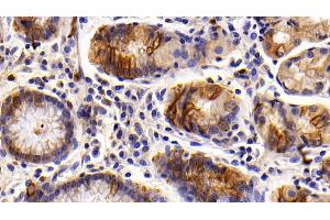 Detection of KRT6A in Human Stomach Tissue using Polyclonal Antibody to Keratin 6A (KRT6A) (KRT6A anticorps  (AA 163-468))