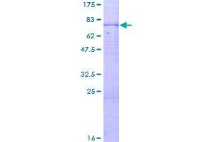 Image no. 1 for Carboxypeptidase N Subunit 1 (CPN1) (AA 1-458) protein (GST tag) (ABIN1350198)