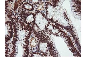 Image no. 10 for anti-Tripartite Motif Containing 38 (TRIM38) (AA 1-265) antibody (ABIN1490681) (TRIM38 anticorps  (AA 1-265))