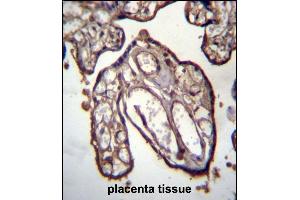 anti-ADP-Ribosylation Factor Interacting Protein 1 (ARFIP1) (AA 147-176) antibody
