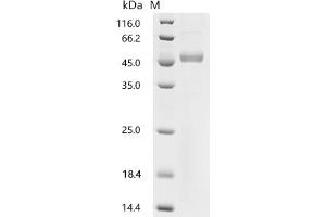 Interleukin 2 (IL2) (AA 21-154), (full length) (Active) protein (hFc Tag)
