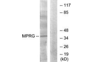 Western blot analysis of extracts from HuvEc cells, using MPRG Antibody. (PAQR5 anticorps  (AA 281-330))