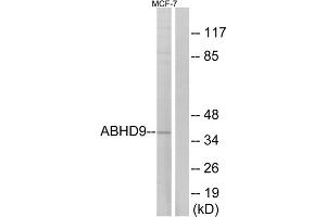 Western blot analysis of extracts from MCF-7 cells, using ABHD9 antibody. (ABHD9 anticorps  (Internal Region))