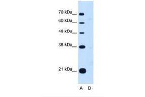 Image no. 1 for anti-Downstream Neighbor of SON (DONSON) (AA 301-350) antibody (ABIN6738192) (DONSON anticorps  (AA 301-350))