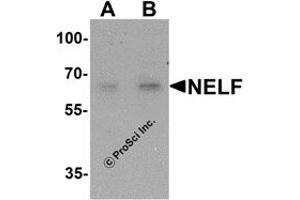 Western Blotting (WB) image for anti-NMDA Receptor Synaptonuclear Signaling and Neuronal Migration Factor (NSMF) antibody (ABIN1077438) (NMDA Receptor Synaptonuclear Signaling and Neuronal Migration Factor (NSMF) anticorps)