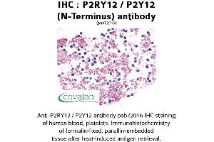 Image no. 1 for anti-Purinergic Receptor P2Y, G-Protein Coupled, 12 (P2RY12) (Extracellular Domain), (N-Term) antibody (ABIN1737755)