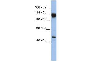 WB Suggested Anti-NRD1 Antibody Titration: 0. (NRD1 anticorps  (Middle Region))