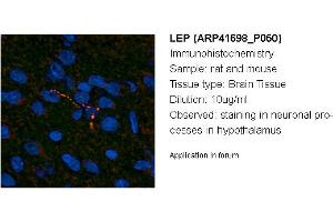 Image no. 1 for anti-Leptin (LEP) (Middle Region) antibody (ABIN2776944) (Leptin anticorps  (Middle Region))