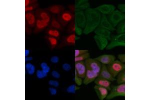 ABIN6264195 and ABIN6266861 staining Hela cells by IF/ICC. (PIAS1 anticorps  (N-Term))