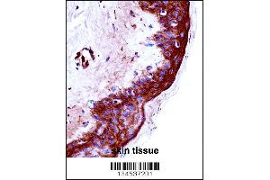KLK9 Antibody immunohistochemistry analysis in formalin fixed and paraffin embedded human skin tissue followed by peroxidase conjugation of the secondary antibody and DAB staining. (Kallikrein 9 anticorps  (AA 82-111))