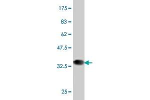 Western Blot detection against Immunogen (37. (PBX1 anticorps  (AA 213-321))