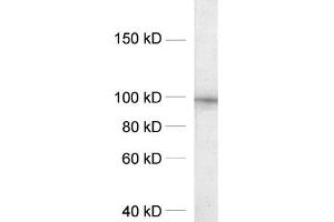 dilution: 1 : 1000, sample: crude synaptosomal fraction of rat brain (P2) (DLG2 anticorps  (AA 22-37))