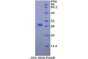 SDS-PAGE analysis of Mouse LOXL3 Protein. (LOXL3 Protéine)
