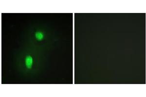 Immunofluorescence analysis of HUVEC cells, using hnRNP C1/C2 antibody. (HNRNPC anticorps  (C-Term))