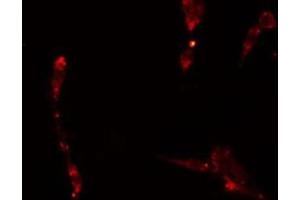 ABIN6275052 staining  A549 cells by IF/ICC.