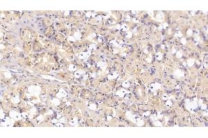 Detection of SHBG in Human Stomach Tissue using Monoclonal Antibody to Sex Hormone Binding Globulin (SHBG)