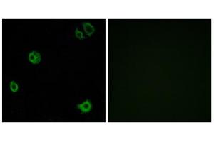 Immunofluorescence analysis of A549 cells, using GPR110 antibody. (G Protein-Coupled Receptor 110 anticorps  (C-Term))
