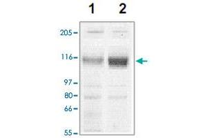 The tissue lysates derived from mouse heart (lane 1) or rat heart (lane 2) were immunoprobed by Corin polyclonal antibody  at 1 : 500. (Corin anticorps  (C-Term))