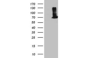 Western Blotting (WB) image for anti-EPM2A (Laforin) Interacting Protein 1 (EPM2AIP1) antibody (ABIN1498046) (EPM2AIP1 anticorps)