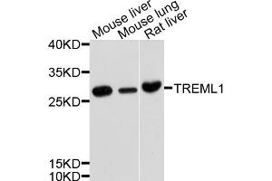 Western blot analysis of extracts of various cell lines, using TREML1 antibody (ABIN4905487) at 1:1000 dilution. (TREML1 anticorps)