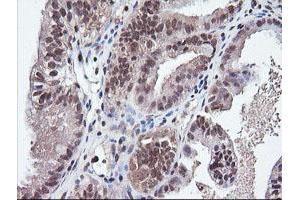 Image no. 3 for anti-Parvin, alpha (PARVA) antibody (ABIN1496442)