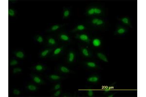 Immunofluorescence of monoclonal antibody to IRF2 on HeLa cell.
