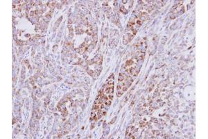 IHC-P Image Immunohistochemical analysis of paraffin-embedded A549 xenograft, using RPS10, antibody at 1:500 dilution. (RPS10 anticorps)