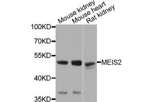 Western blot analysis of extracts of various cell lines, using MEIS2 antibody. (MEIS2 anticorps)