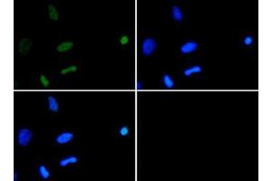 Immunofluorescence of Rabbit Anti-Histone H3 [ac Lys18] Antibody.