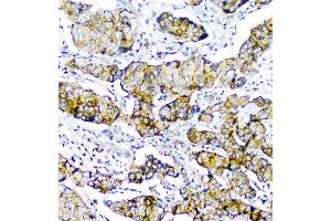 IHC analysis of CD2AP using anti-CD2AP antibody (ABIN6719544). (CD2AP anticorps  (AA 253-337))