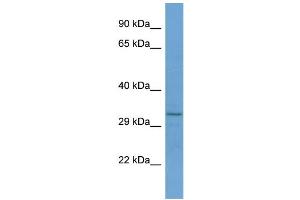 Host:  Rabbit  Target Name:  RNF150  Sample Type:  Jurkat Whole cell lysates  Antibody Dilution:  1. (RNF150 anticorps  (C-Term))