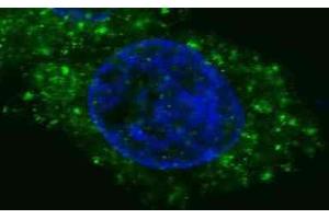 Immunofluorescence (IF) image for anti-Met Proto-Oncogene (MET) antibody (ABIN2995277) (c-MET anticorps)
