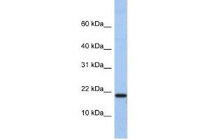 C1D antibody used at 0. (C1D anticorps  (N-Term))