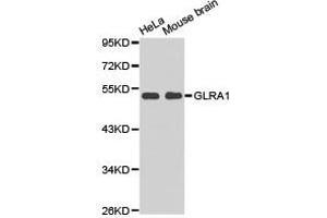 Western Blotting (WB) image for anti-Glycine Receptor, alpha 1 (GLRA1) antibody (ABIN1872831) (GLRA1 anticorps)
