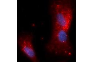 Immunofluorescence (IF) image for anti-Complement Factor Bb antibody (APC) (ABIN5564989) (Complement Factor Bb anticorps  (APC))