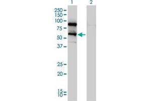 Western Blot analysis of DDX41 expression in transfected 293T cell line by DDX41 monoclonal antibody (M01), clone 2F4. (DDX41 anticorps  (AA 523-622))