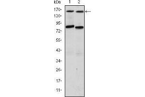 Western blot analysis using AIB1 mouse mAb against T47D (1) and MCF-7 (2) cell lysate.