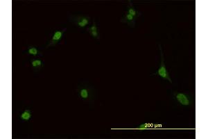 Immunofluorescence of monoclonal antibody to PBX1 on HeLa cell.