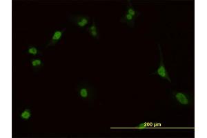 Immunofluorescence of monoclonal antibody to PBX1 on HeLa cell. (PBX1 anticorps  (AA 213-321))