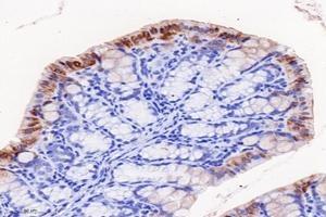 Immunohistochemistry analysis of paraffin-embedded mouse colon using,FGF10 (ABIN7073940) at dilution of 1: 8000 (FGF10 anticorps)