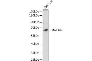 Western blot analysis of extracts of Rat liver, using UGT1 antibody (ABIN6132769, ABIN6149895, ABIN6149896 and ABIN6221779) at 1:2130 dilution. (UGT1A1 anticorps  (AA 1-200))