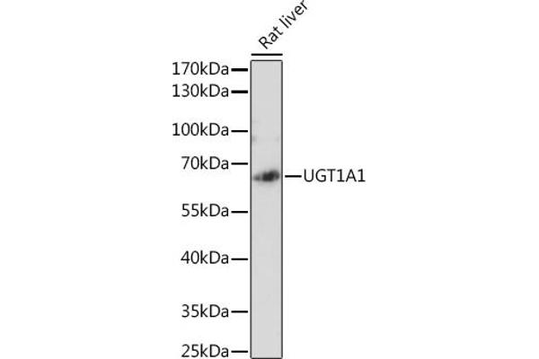 UGT1A1 抗体  (AA 1-200)
