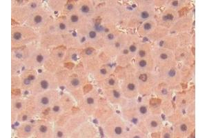 Detection of COL8a1 in Human Liver Tissue using Polyclonal Antibody to Collagen Type VIII Alpha 1 (COL8a1)