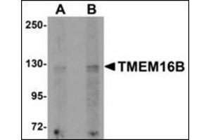 Western blot analysis of TMEM16B in rat brain tissue lysate with TMEM16B antibody at (A) 1 and (B) 2 µg/ml. (Anoctamin 2 anticorps  (N-Term))