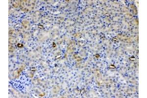 IHC testing of FFPE mouse kidney tissue with ALDH1A3 antibody at 1ug/ml. (ALDH1A3 anticorps)